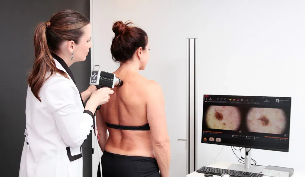 Dermatoscopia Digital Dra Ana Flavia Moraes Dermatologista Viala Mariana SP