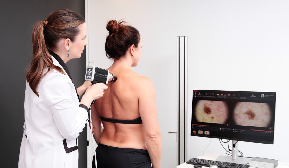 Dermatoscopia Digital Dra Ana Flavia Moraes Dermatologista Viala Mariana SP