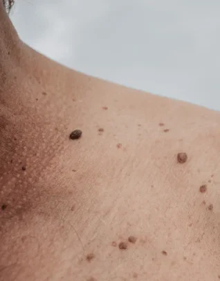 Dra. Ana Flavia Imagens Blog Tenho Muitas Pintas