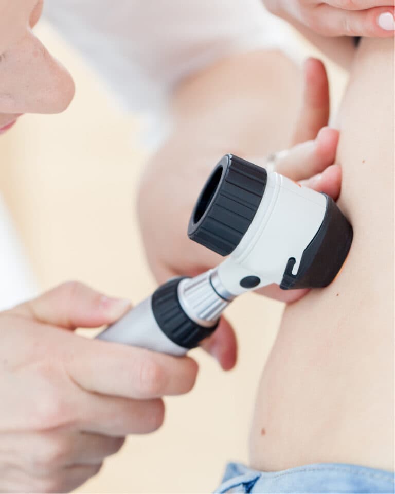 Pinta Patinho Feio Dra Ana Flavia Moras Dermatologista SP –